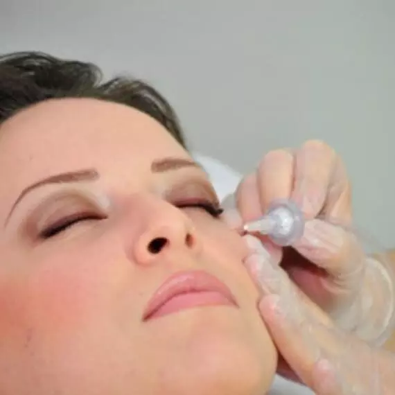 Carboxiterapia Facial